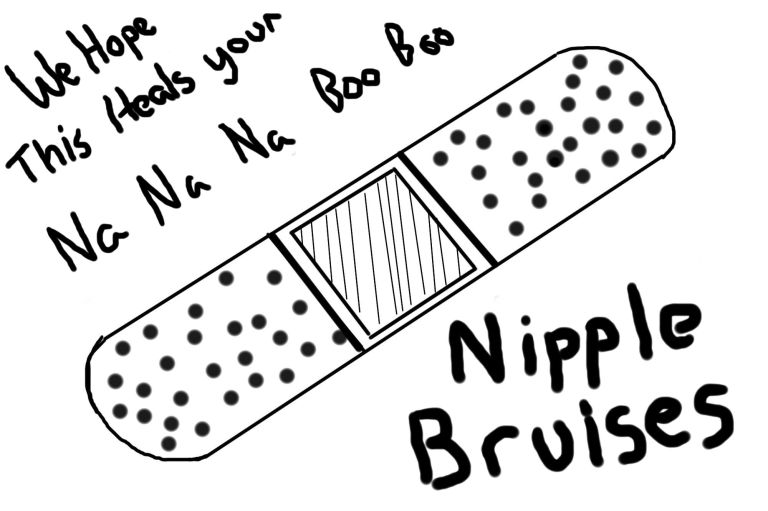 nipplebruises
